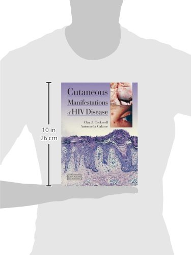 Cutaneous Manifestations of HIV Disease