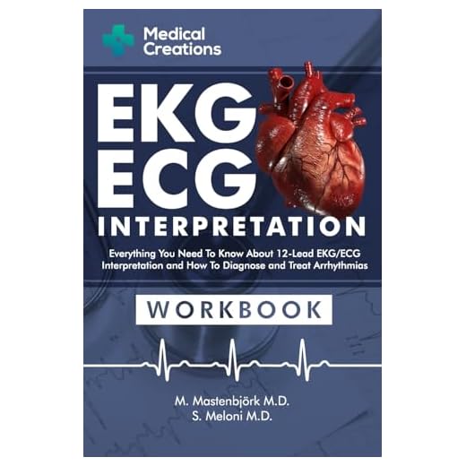 EKG/ECG Interpretation: Everything you Need to Know about the 12 - Lead ECG/EKG Interpretation and How to Diagnose and Treat Arrhythmias: Workbook