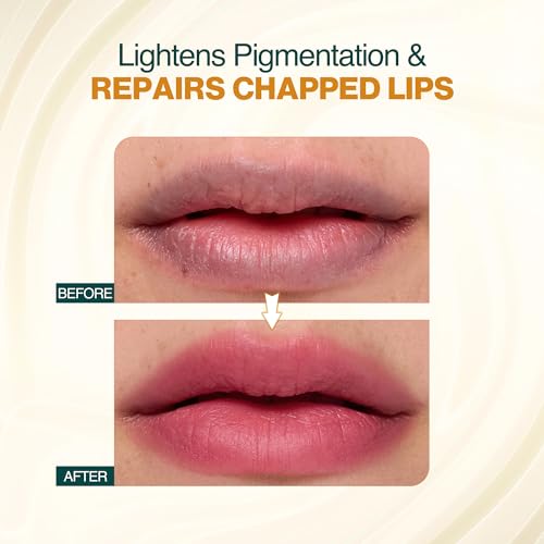 Nourish Mantra Beetroot Blast Lip Balm with SPF/Formulated with Beetroot Extracts, Olive Oil, Shea Butter, Vitamin E, and Avocado Oil/Best for both women and men/ 12gms