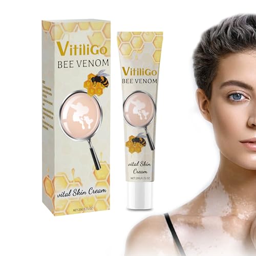 Vitiligo Cream - Bee Venom Effective Cream to Reduce White Spots ...