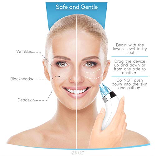 Limpiador de Poros Succionador de Puntos Negros y Espinillas Extractor Puntos Negros Removedor Aparato para Quitar Acne… - Imagen 3
