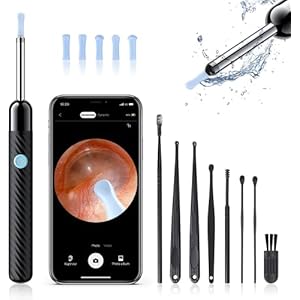 Ear Wax Removal – Earwax Remover Tool with 8 Pcs Ear Set – Ear Cleaner with Camera – Earwax Removal Kit with Light – Ear…