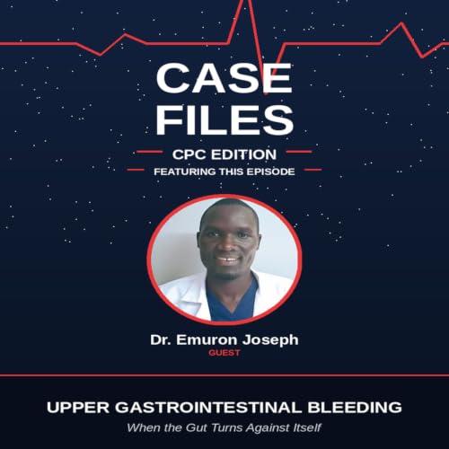 "Vomiting Blood": Upper GI Bleeding When the Gut Turns Against Itself