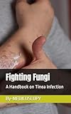 Fighting Fungi: A Handbook on Tinea Infection