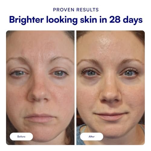 Bliss Vitamin C + Tri-Peptide Face Serum - Stabilized Vitamin C for Dark Spots, Fine Lines & Firmness - Brightening Serum with Collegen Boosting Peptides, Hyaluronic Acid, Squalane - 1 Fl Oz - Image 3