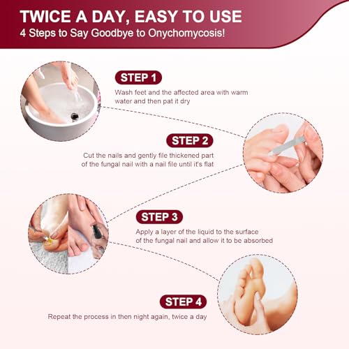 Toenail Fungus Treatment, Treatment Extra Strength with 25% Undecylenic Acid, Fungus Nail Treatment for Damaged Nails, Discolored, Thick Toenails, Help Nail Grow - (1 Fl Oz/30 ml x 5 Pack)
