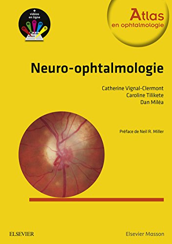 Neuro-ophtalmologie (Atlas en Ophtalmologie) PDF Ebook En Ligne