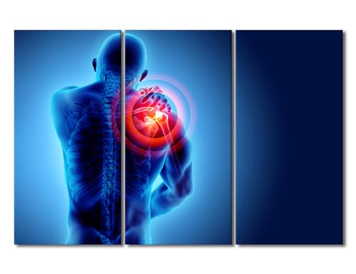 3 Panel Canvas Wall Art Medical Concept Wall Painting Modern Wall Art for Home Decorations, X-Ray Artwork Concept Posters Wooden Framed Gallery-Wrapped Ready to Hang, 60" Wx40 H