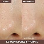 Innisfree Super Volcanic Clay Mask, Premium Korean Skincare with AHA and Natural Clusters for Deep Pore Detox, Gentle Exfoliation, Oil Control - Image 4