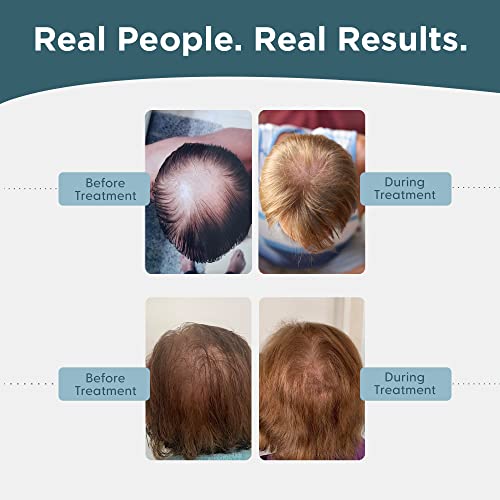 Mens-Regrowth-Kit-Plus-Shampoo-Conditioner-5-Minoxidil-Leave-In-Foam-Complete-Anti-Hair-Loss-and-Thinning-Hair-Solution-for-Men-1-Month-Supply