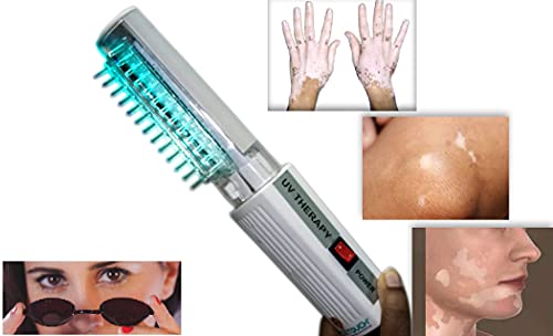 INDETOUCH Store INDETOUCH NBUVB Phototherapy Light Device - Image 4