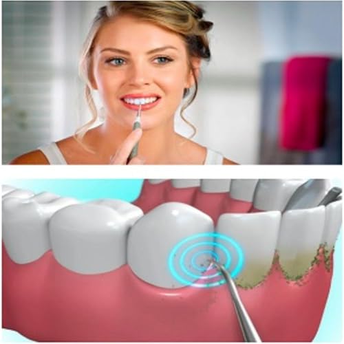 Image of Electric Ultrasonic Tooth Stain Eraser Plaque Remover Dental Tool Teeth Whitening Dental Cleaning Scaler Tooth Odonto Logia Too