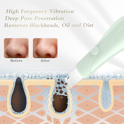 Save 30% on Dual-Mode Blackhead Remover Tool for Deep Cleansing