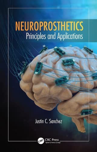 Buy Neuroprosthetics: Principles and Applications (Rehabilitation Science in Practice Series) — BookShops.in