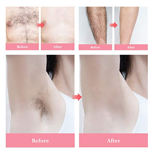Y.F.M 500ML Waxing Kit for Women, Professional Wax Warmer with 4 x 100g Wax Beans, Adjustable Temperature for All Wax/Hair Types, Eyebrow, Facial, Body, Bikini, Brazilian