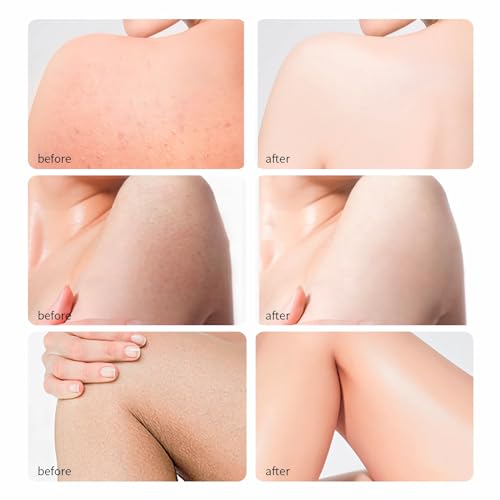 [Pack Of 3] Mercham Pure Natural Body Oil For Dry Skin, Super Moisturize And Anti-Aging, Organic Body Oils For Face, Hair, Nails, Massage, Stretch Marks, Vegan Body Skin Care Oil For Women -120Ml*3 - 4