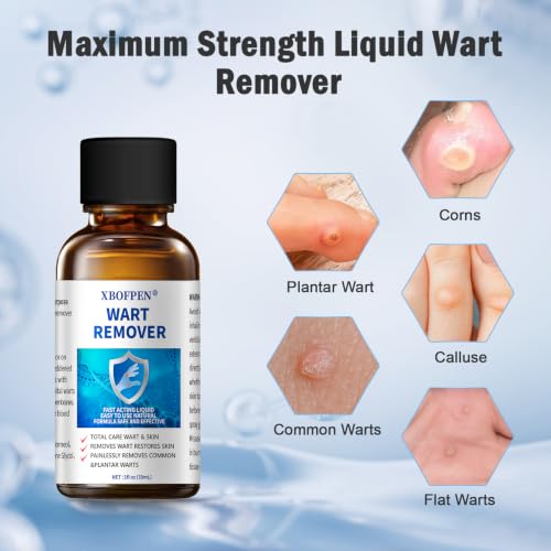 Image of Wart Remover, Plantar Wart Corn Remover Freeze Off for Feet