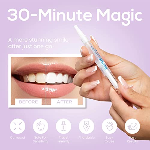 image for Venus Visage Teeth Whitening Pen (2 Pens), 20+ Uses - DENTIST APPROVED