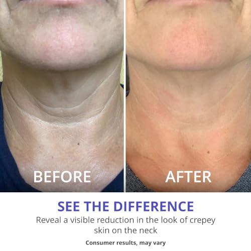 goPure Tighten & Lift Neck & Chest Moisturizer Cream for Visibly Firming, Tightening and Lifting Wrinkles & Crepey Skin, 1.7oz - Pack of 2