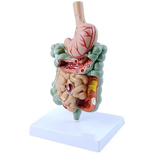 Modèle de système digestif AMITD pour comprendre le côlon pathologique - 2