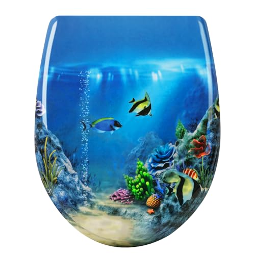 WOLTU Abattant WC, Lunette WC, Abattant WC avec Frein de Chute, Lunette de Toilette, Dégagement Rapide, en Forme O, Montage par le haut ou par le bas, en UF,...