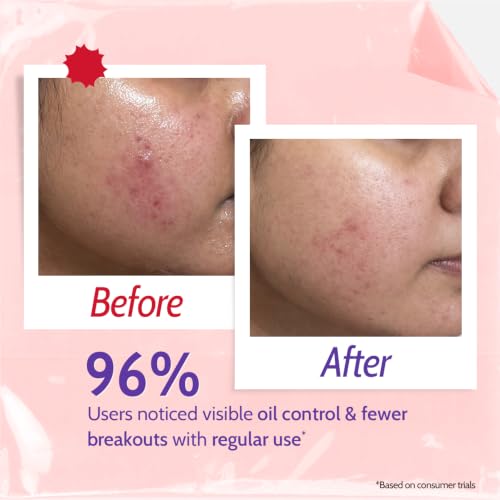 Image of Chemist At Play 2% Salicylic Acid Face Wash for Oily & Acne-Prone Skin | Controls Oil, Prevents Acne & Fades Acne Marks | With Niacinamide | Soap-Free, Sulphate-Free Cleanser | For Men & Women |100 ml