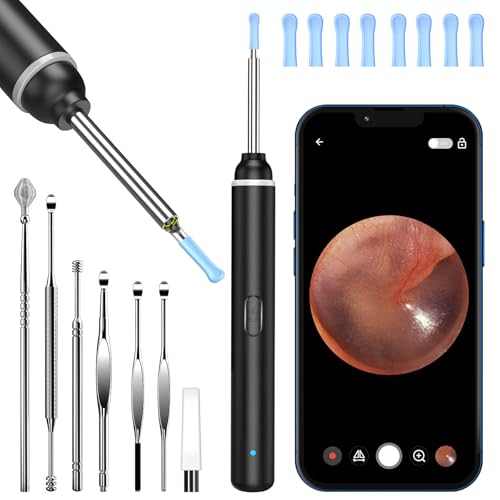Ear Wax Removal Kit 1920P HD Ear Cleaner with Camera Ear Wax Remover Tool WiFi Otoscope with 6 LED Lights & 8 Ear Spoons Visual Ear Scope for iPhone iPad Android Adults Pets(Black)