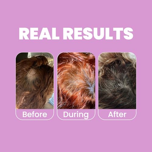 Anyeluz Onion Shampoo and Conditioner Set - Salt Free & Keratin Safe - Hair Growth Duo with Onion Extract and Biotin - 16.9 Fl Oz (Pack of 2)