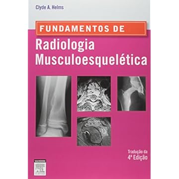 Capa do livro Fundamentos de radiologia musculoesquelética