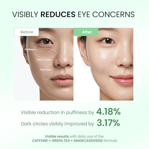 Dongyu Eye Cream Anti Aging: Caffeine Green Tea Eye Cream for Beauty Enthusiasts - Puffy Eye Treatment Morning Night Use (Green) - Image 3