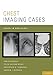 Chest Imaging Cases (Cases in Radiology)