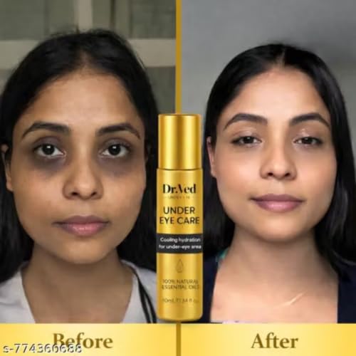 Generic Under Eye Roll-On 10 ml - Image 3