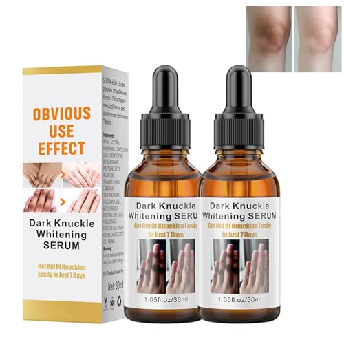 Sérum blanqueador de la piel, suero blanqueador de la piel, suero blanqueador de la piel oscura, reduce la edad de hiperpigmentación, elimina los nudillos oscuros de los dedos, para nudillos, codos