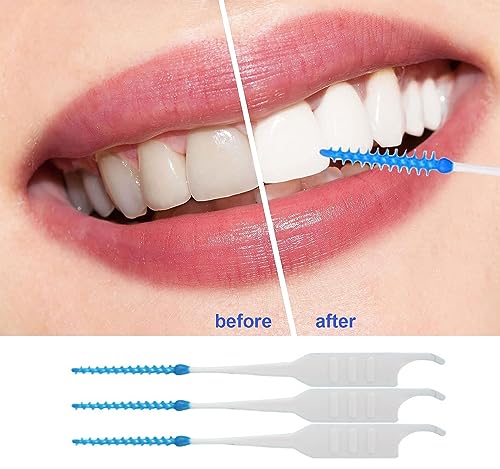 FaJoek Interdentale borstels, 200 stuks, tandenstokers, 0,7 mm, tandenstoker, tandenverzorgingsborstel, voor het reinigen van de tanden (Blau:200PCS, set) – Bild 6