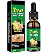 LYEAA Nagelschimmelbehandeling, 7 dagen nagelschimmelbehandeling, voetnagels, nagelriemen verzorgingsolie, gember knaag...