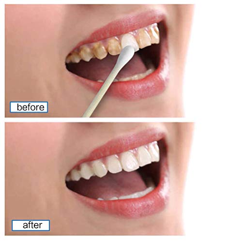 Sbiancamento Kit Teeth Whitening Essence polvere