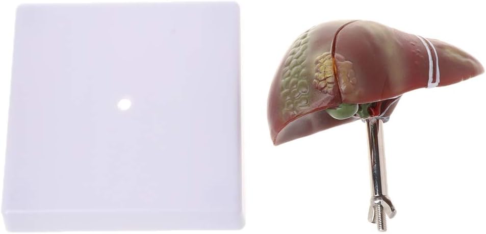 MOMOJIA Human Liver Pathological Anatomical Model Anatomy School Teaching Display Tool Lab Equipment