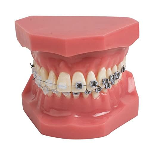 Modelli di Denti per Studenti di Odontoiatria, Modello Dentale Modello Ortodontico con Apparecchi in Ceramica E Metallo, Ottimo per L'insegnamento Scolastico E L'apprendimento degli Studenti, Mate