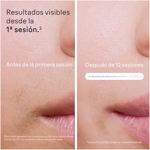 Miniatura 4 de Braun Depiladora Luz Pulsada Skin i·expert Smart IPL, PL7387, Blanco/Bronce | Alternativa a Depiladora Laser con Inteligencia Artificial, Elimina el Vello en Casa, Neceser, Maquinilla Venus, 4 Cabezales