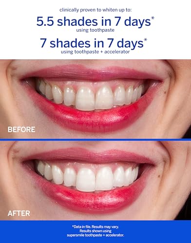 Image of Supersmile Peppy Mint Whitening Toothpaste, Fluoride-Free, 8 Oz | Calprox Powered, Whitens 5.5 Shades in 7 Days, Candy Cane Flavor Without the Sugar, Veneer Safe, SLS-Free
