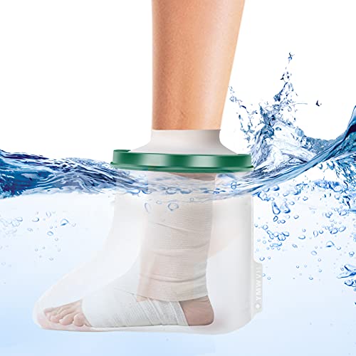 45 Best cast covers cvs 2022 After 187 hours of research and testing.