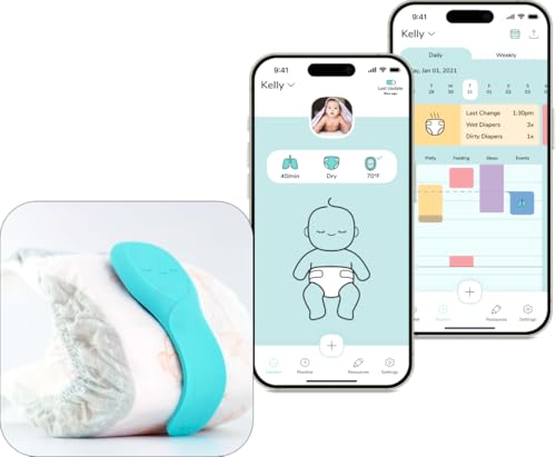 Image of Aurio Smart Baby Monitor – Tracks Breathing Rate, Sleep, Diaper Wetness, Temperature, Real-Time Alerts with Patented Technology