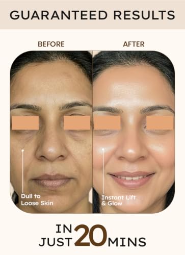 Image of Wildglow Kaolin Clay Instant Face Lifting Mask with Niacinamide & Turmeric & Vitamin B3 that tightens skin, refines pores, & boosts glow | Wrinkle Free in just 20 mins | Face Pack for Oily & Combination Skin | 118g