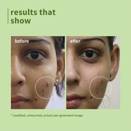 Image of Plum Green Tea Pore Cleansing Face Wash for Oily, Acne Prone, Dry & Combination Skin | with Glycolic Acid | Fight Pimples & Control Excess Oil | Gentle Exfoliating & Non-Drying | Women & Men | 50ml (Pack of 2)