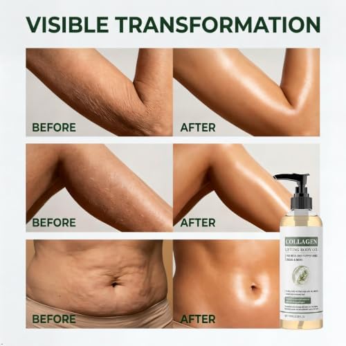 SBONFE Collagen Body Oil for Skin Tightening–Firming & Lifting Hydration - 3