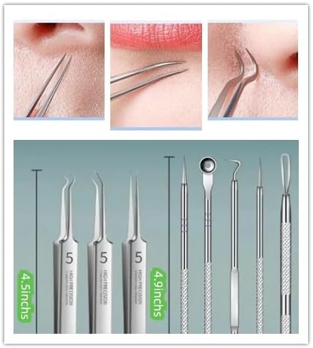 Miniatura 6 de Kit de pinzas para eliminar puntos negros, pinzas ultrafinas, extractor de manchas de puntos negros, aguja de acné, limpiador facial, herramienta