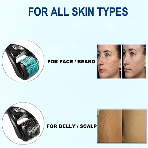 Angel Kiss Microneedling Roller Derma Roller for Beard Face Body - 2 Pack 540 Titanium Micro Needles Roller for Home - Self Care Gifts for Man ane Woman - Image 3