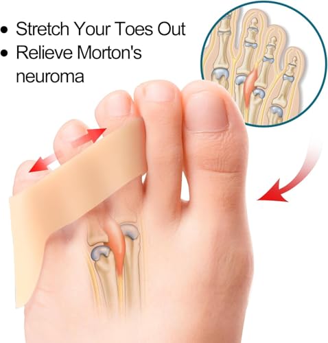 Image of Toe Separator for Feet Toe Spacers Correct Toes Yoga Silicone Hammer Toe Corrector for Women & Men Correct Toe Straighteners for Overlapping Toes (L F t separator)