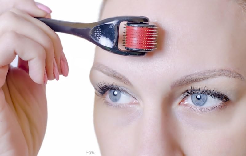 Derma Roller for Face and Skin Care - 540 Titanium Needles, 2mm - 4017 - Image 3