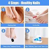 AOOWU Nail Fungus Laser Device with Time Display, Portable Fungal Nail Treatment for Toenails Extra Strong, 7-Minute Toenail Fungus Treatment, 940nm Infrared Light 500nm Blue Light, Safer Painless - Image 6